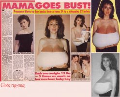 The Biggest Gigantomastia Tits Ever Literally!!!! Page 180 T