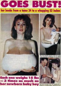 The Biggest Gigantomastia Tits Ever Literally!!!! Page 180 T