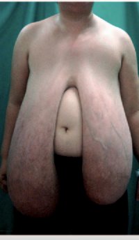 Saggy tits thread, Page 26