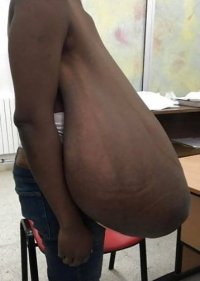 Togo Girl 62 pounds breasts.jpg